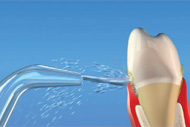 Zahnmedizinische Herausforderungen beim Rauchen und der Behandlung von Zahnfleischerkrankungen